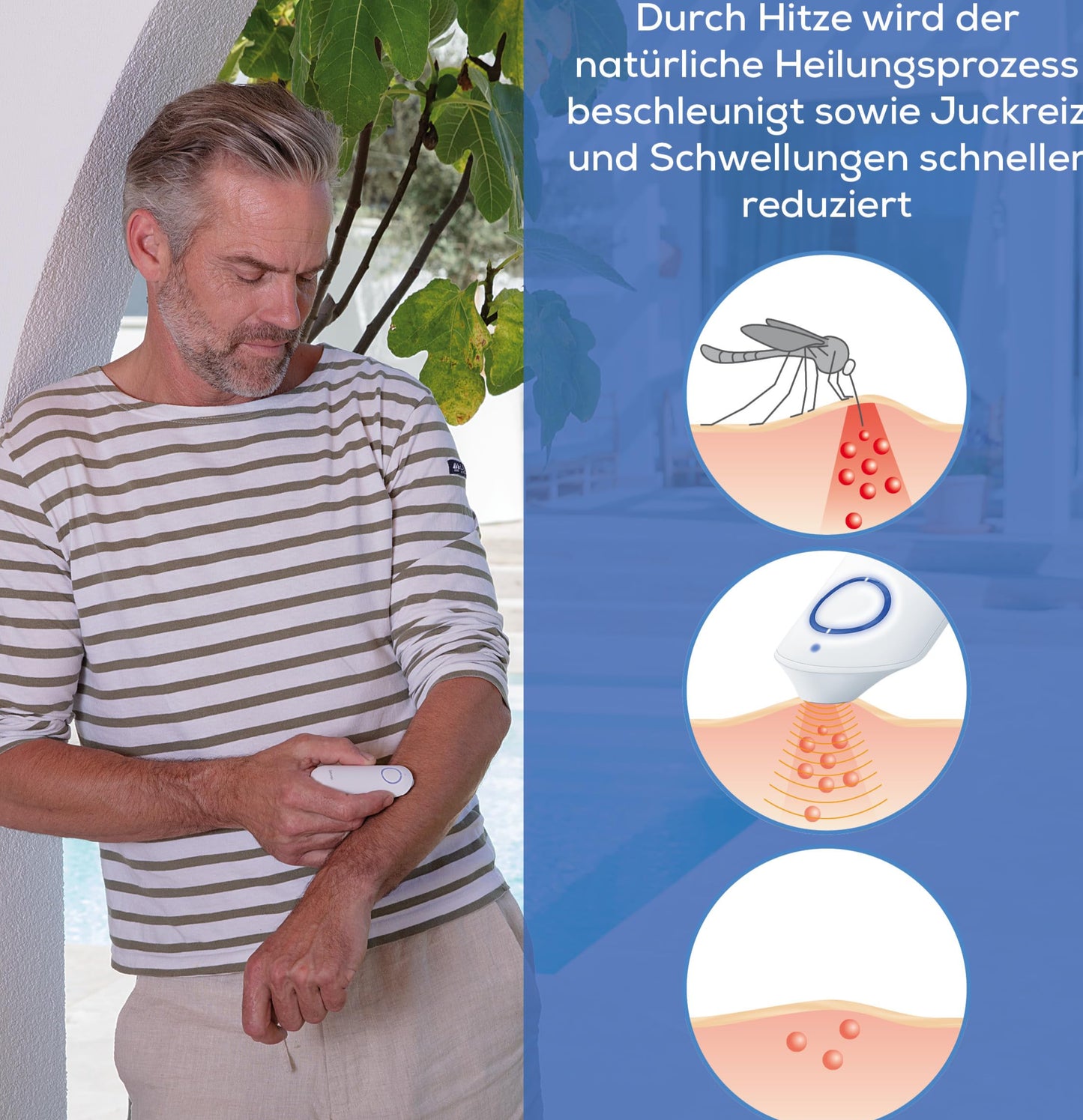 Beurer BR 60 Stichheiler – Hitzestift gegen Insektenstiche